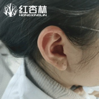 紅杏林中醫(yī)動(dòng)作示范